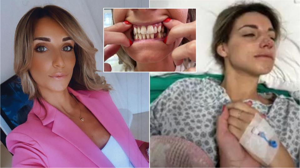 Women with phobia of dentist left traumatised after botched procedure for new teeth