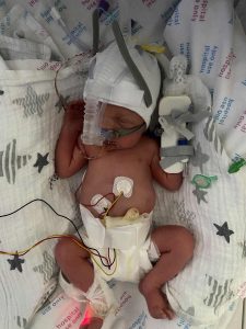 I saved my baby when his heart stopped using CPR