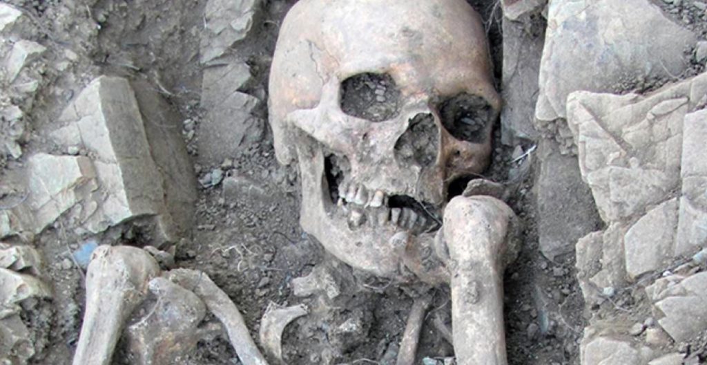 Ancient skeleton with rare disease causing tiny testicles discovered 