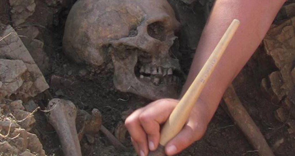 Ancient skeleton with rare disease causing tiny testicles discovered 